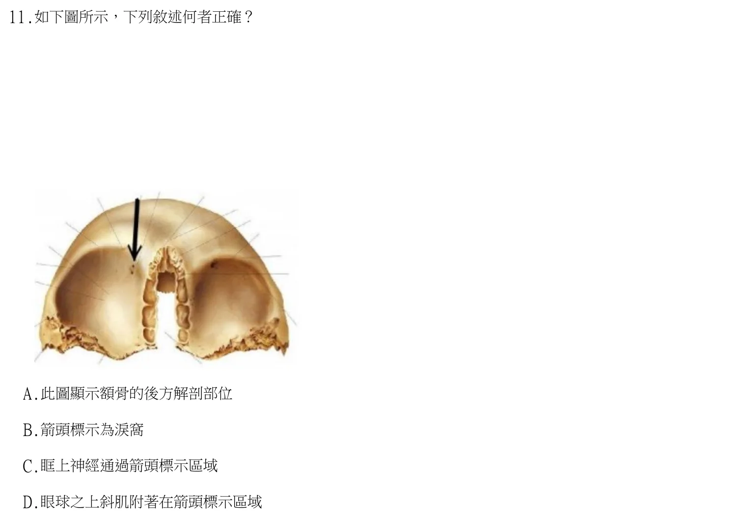 113 年第二次 牙醫學（一） 第 11 題附圖