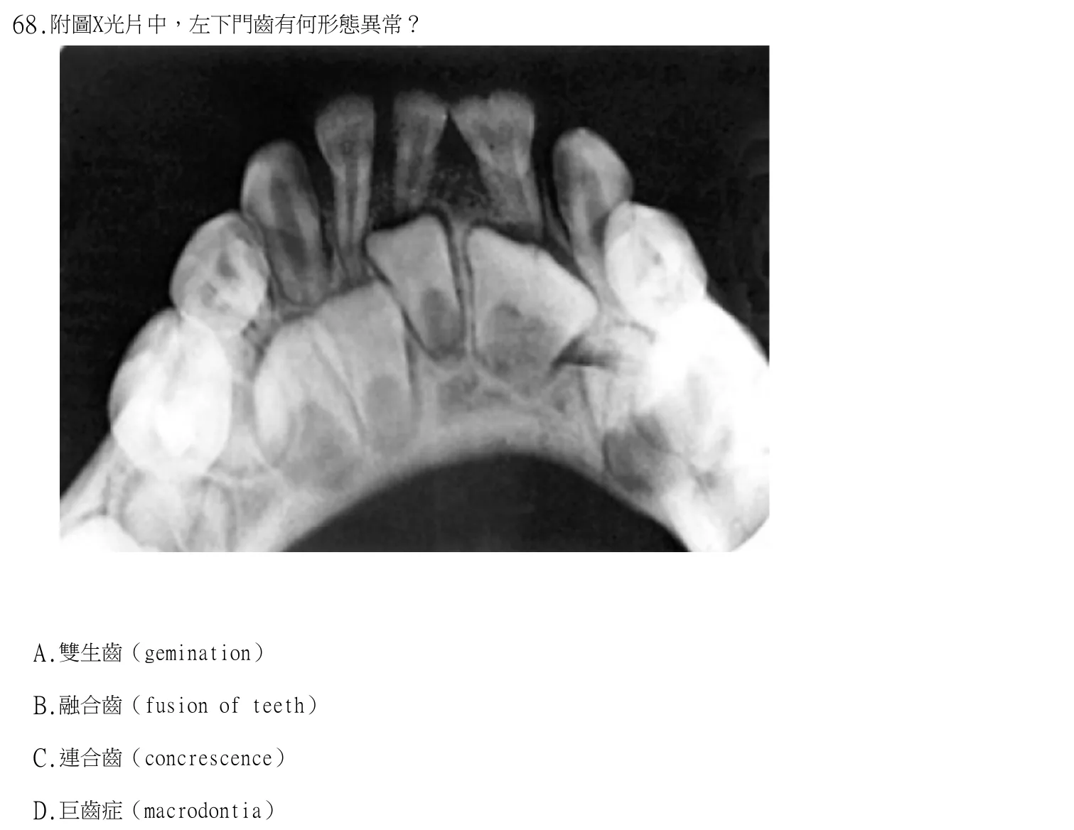 113 年第二次 牙醫學(四) 第 68 題附圖