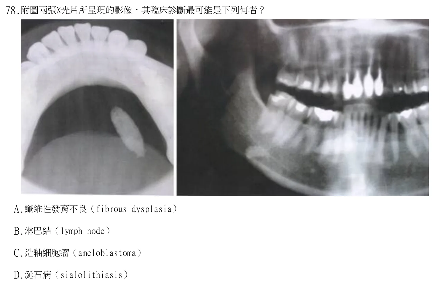 113 年第二次 牙醫學(四) 第 78 題附圖