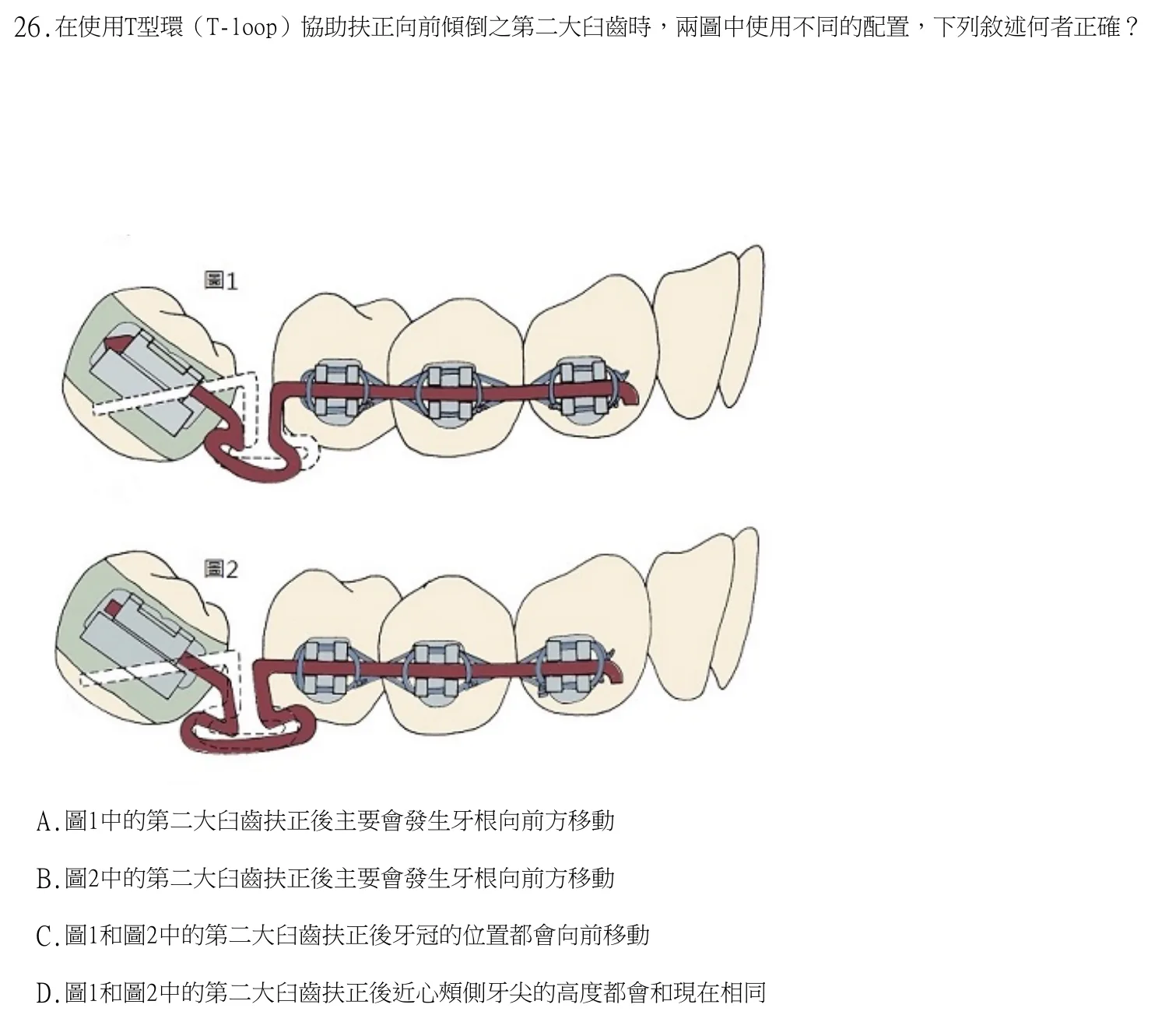113 年第二次 牙醫學（六） 第 26 題附圖