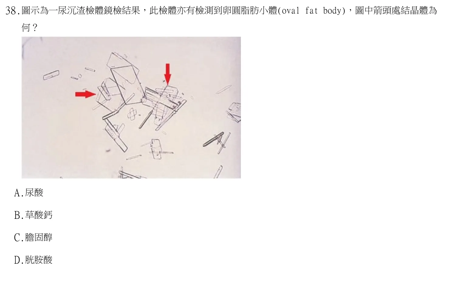 113 年第二次 醫學分子檢驗學與臨床鏡檢學 第 38 題附圖