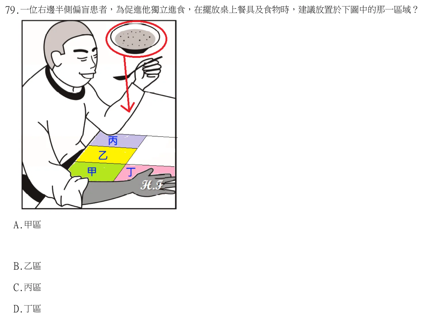 113 年第二次 物理治療技術學 第 79 題附圖