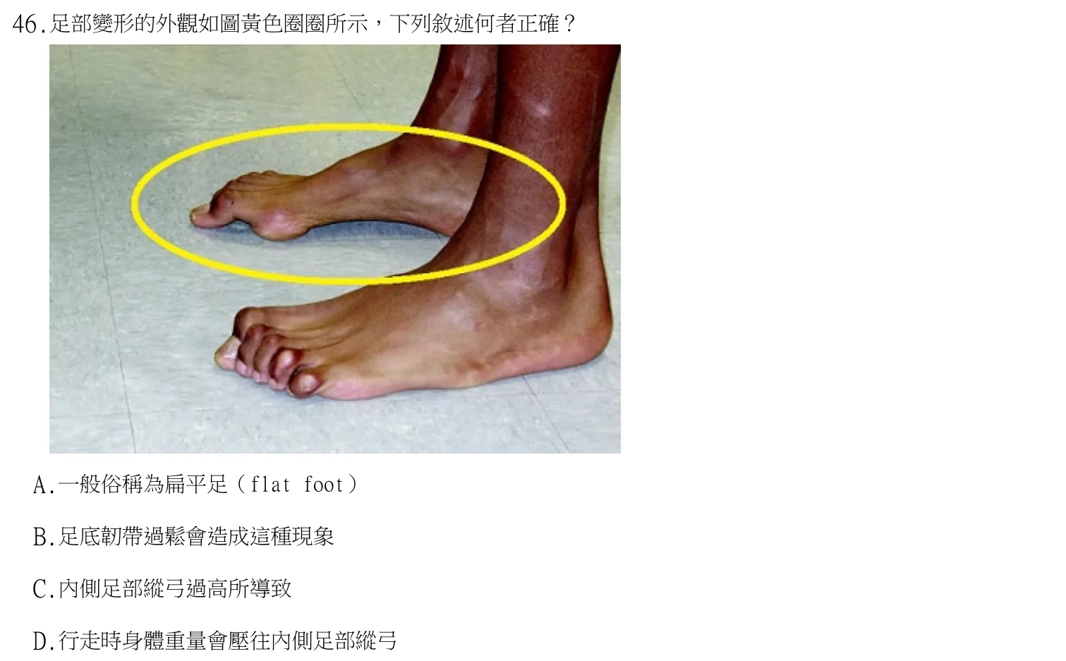 113 年第二次 職能治療技術學 第 46 題附圖