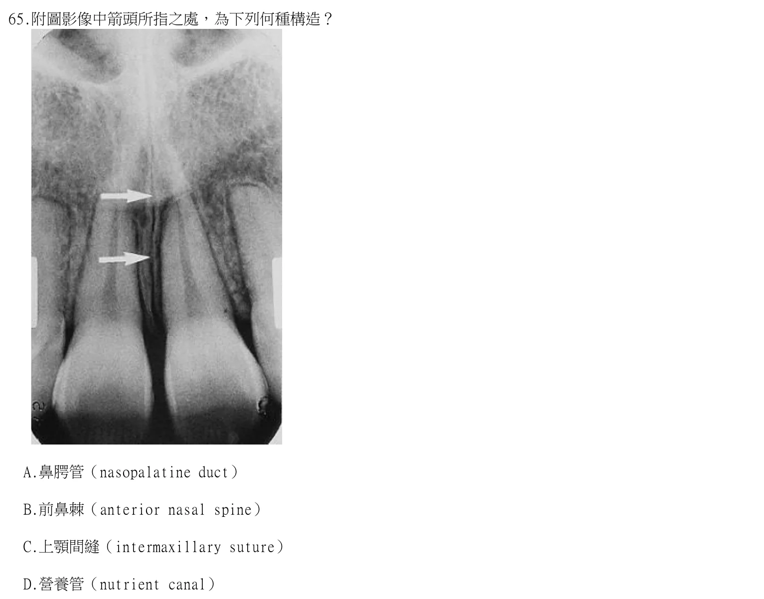 114 年第一次 牙醫學（四） 第 65 題附圖