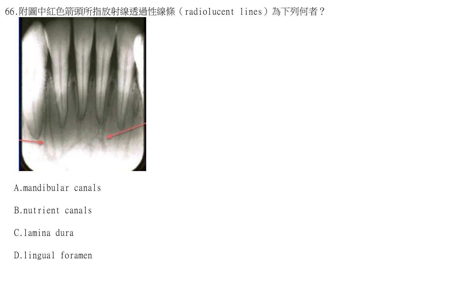 114 年第一次 牙醫學（四） 第 66 題附圖