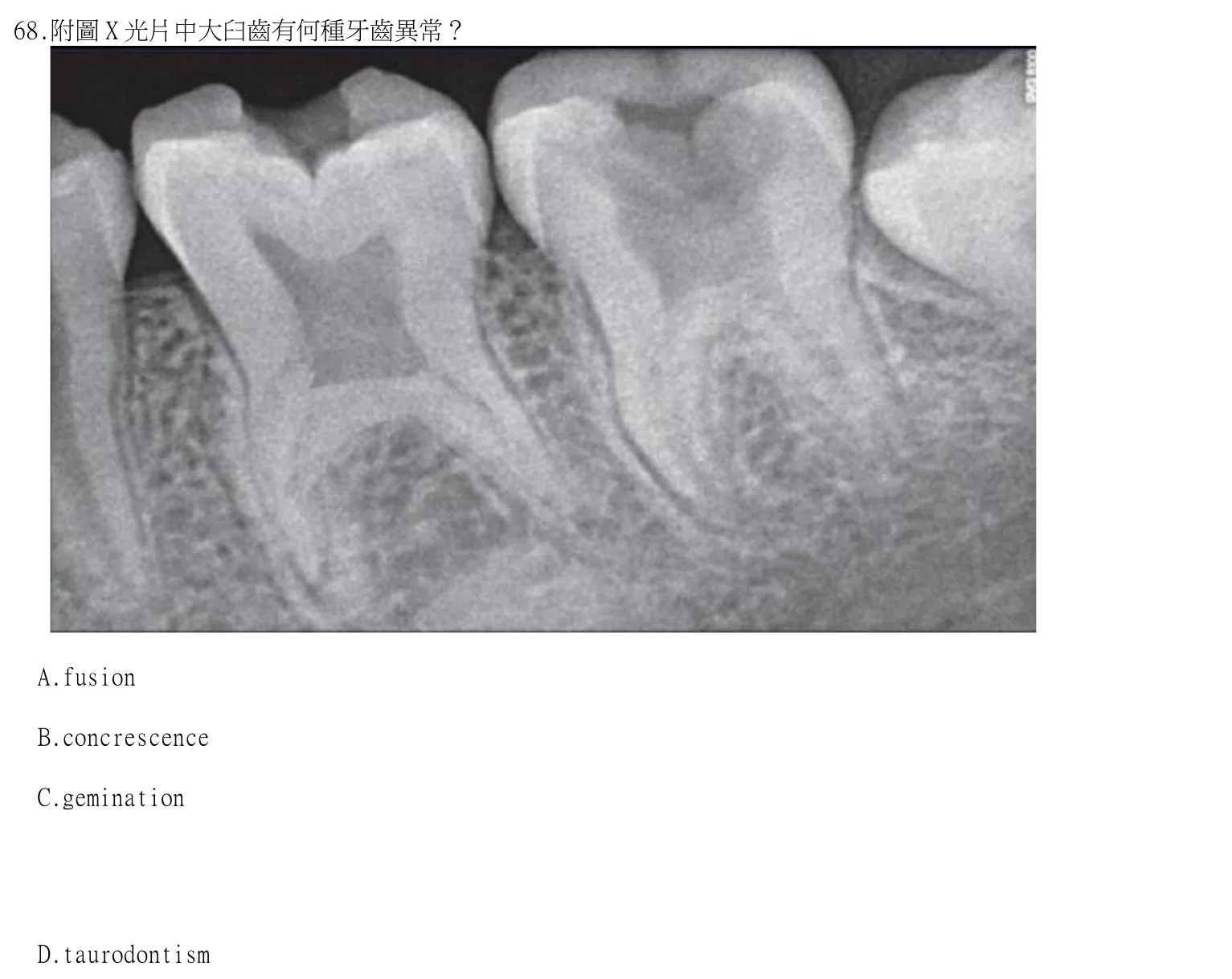 114 年第一次 牙醫學（四） 第 68 題附圖