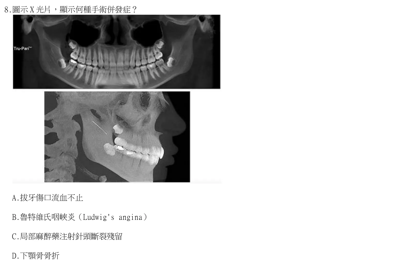 114 年第一次 牙醫學（四） 第 8 題附圖