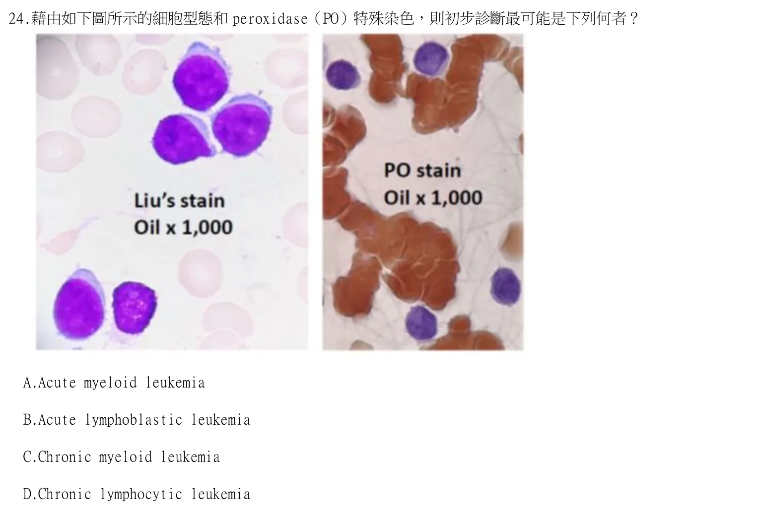 114 年第一次 臨床血液學與血庫學 第 24 題附圖