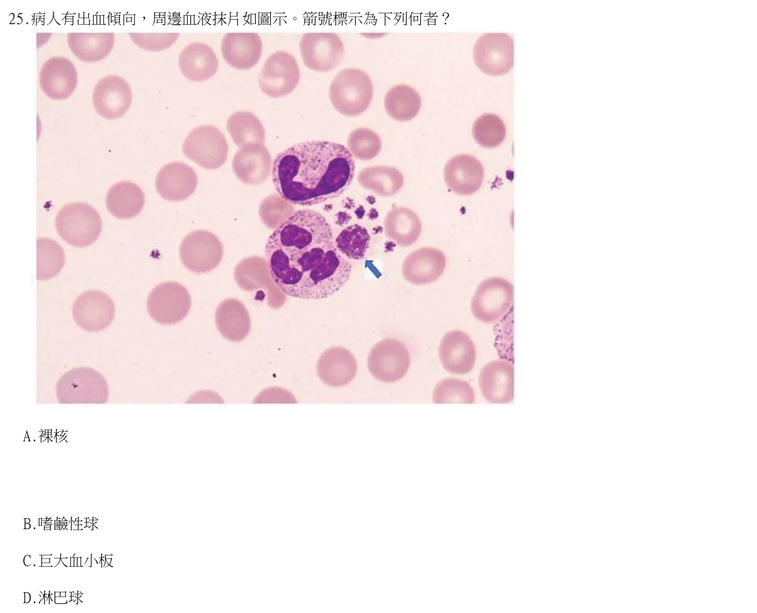 114 年第一次 臨床血液學與血庫學 第 25 題附圖