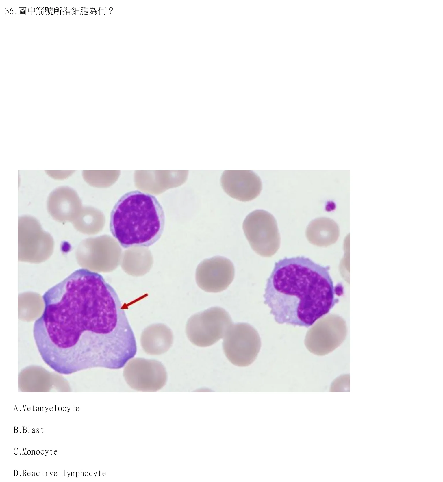 114 年第一次 臨床血液學與血庫學 第 36 題附圖