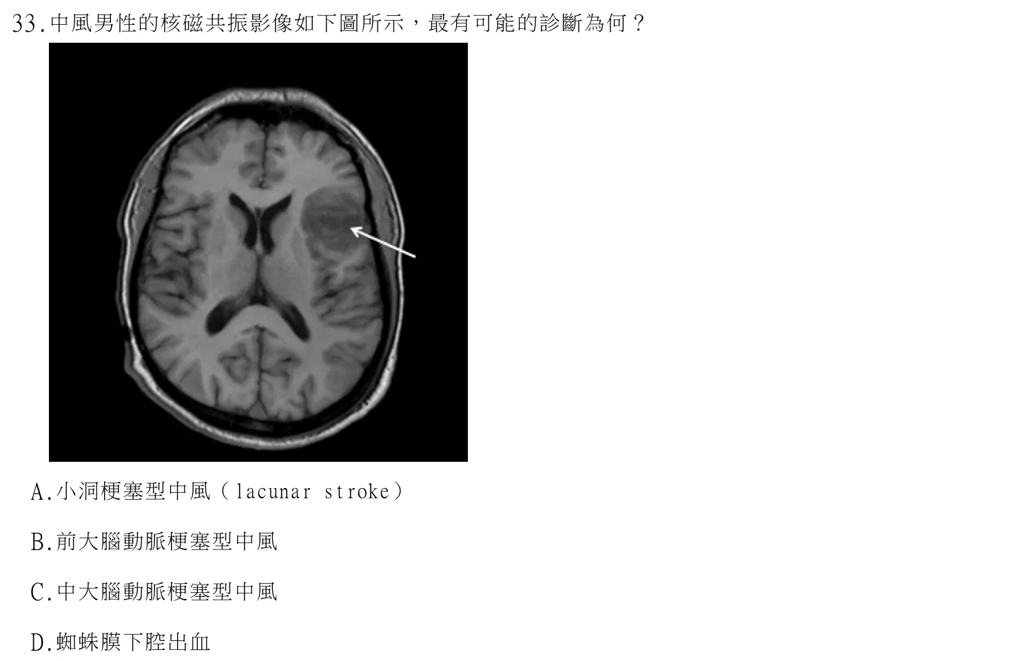114 年第一次 神經疾病物理治療學 第 33 題附圖