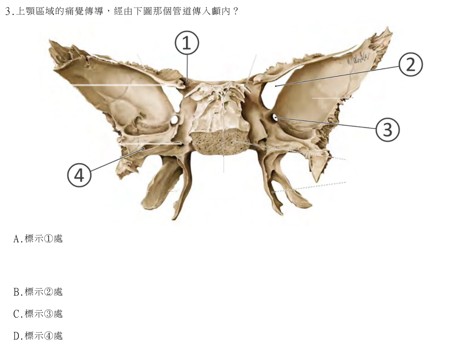 114 年第二次 牙醫學（一） 第 3 題附圖