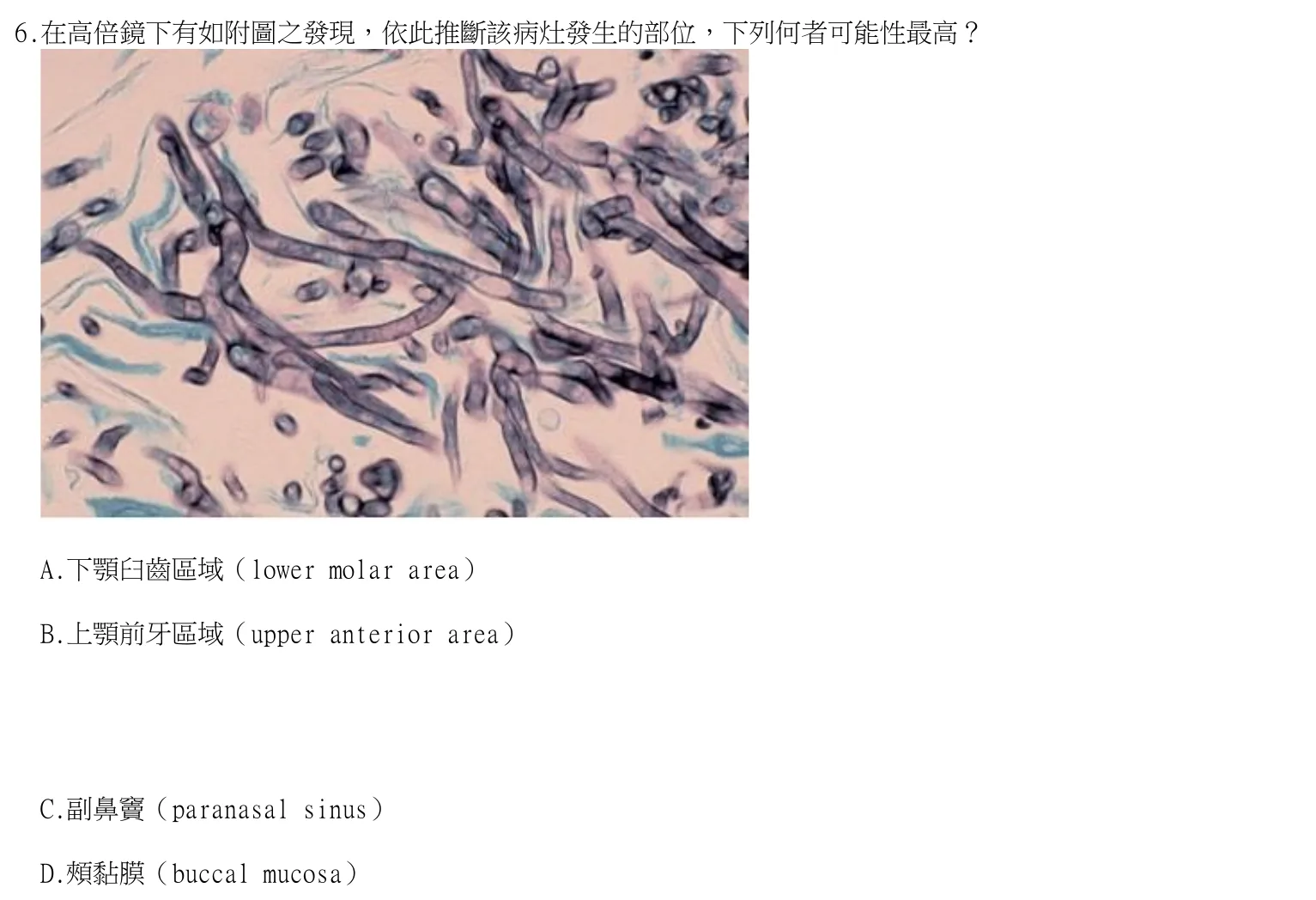 114 年第二次 牙醫學（二） 第 6 題附圖