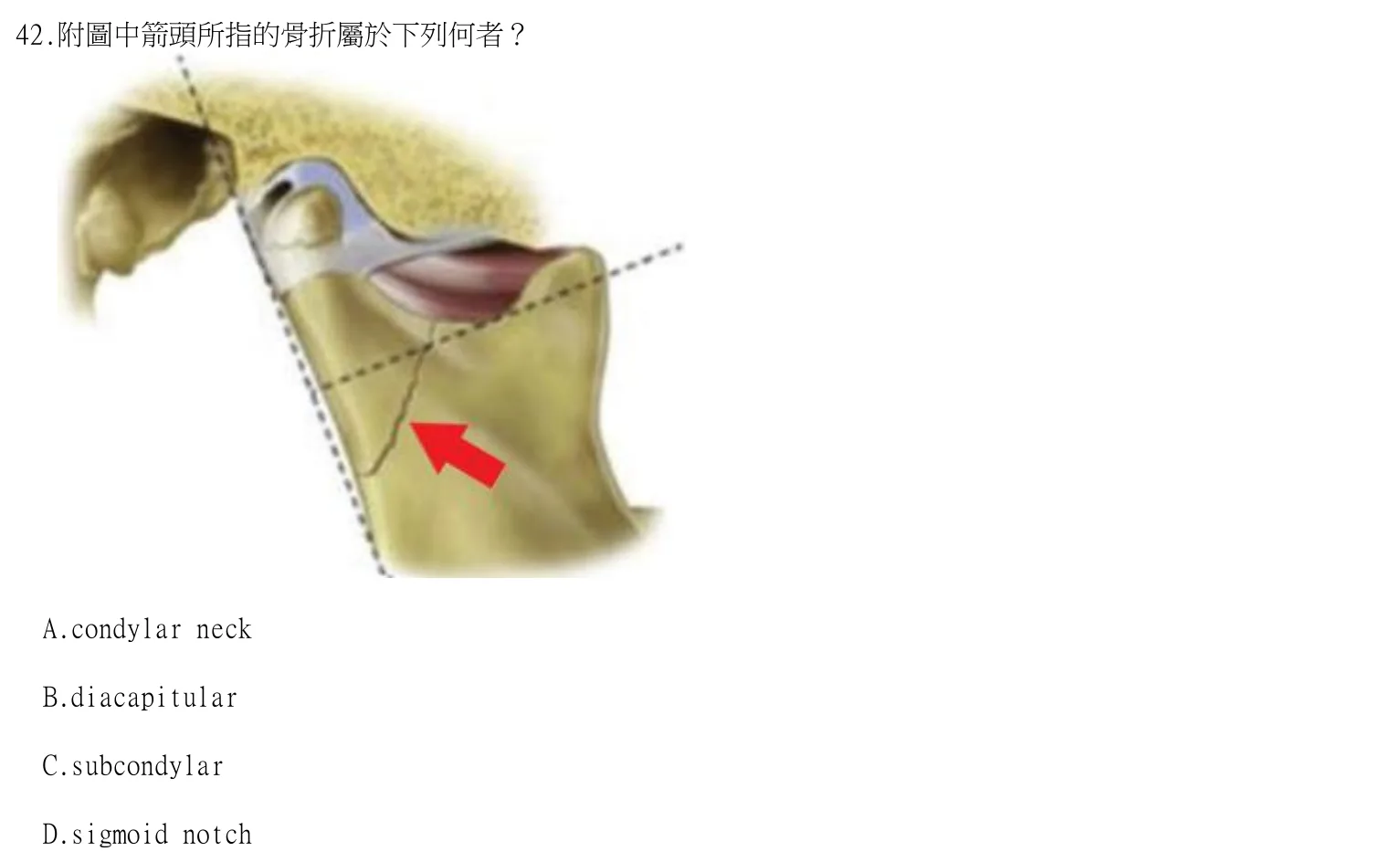 114 年第二次 牙醫學（四） 第 42 題附圖