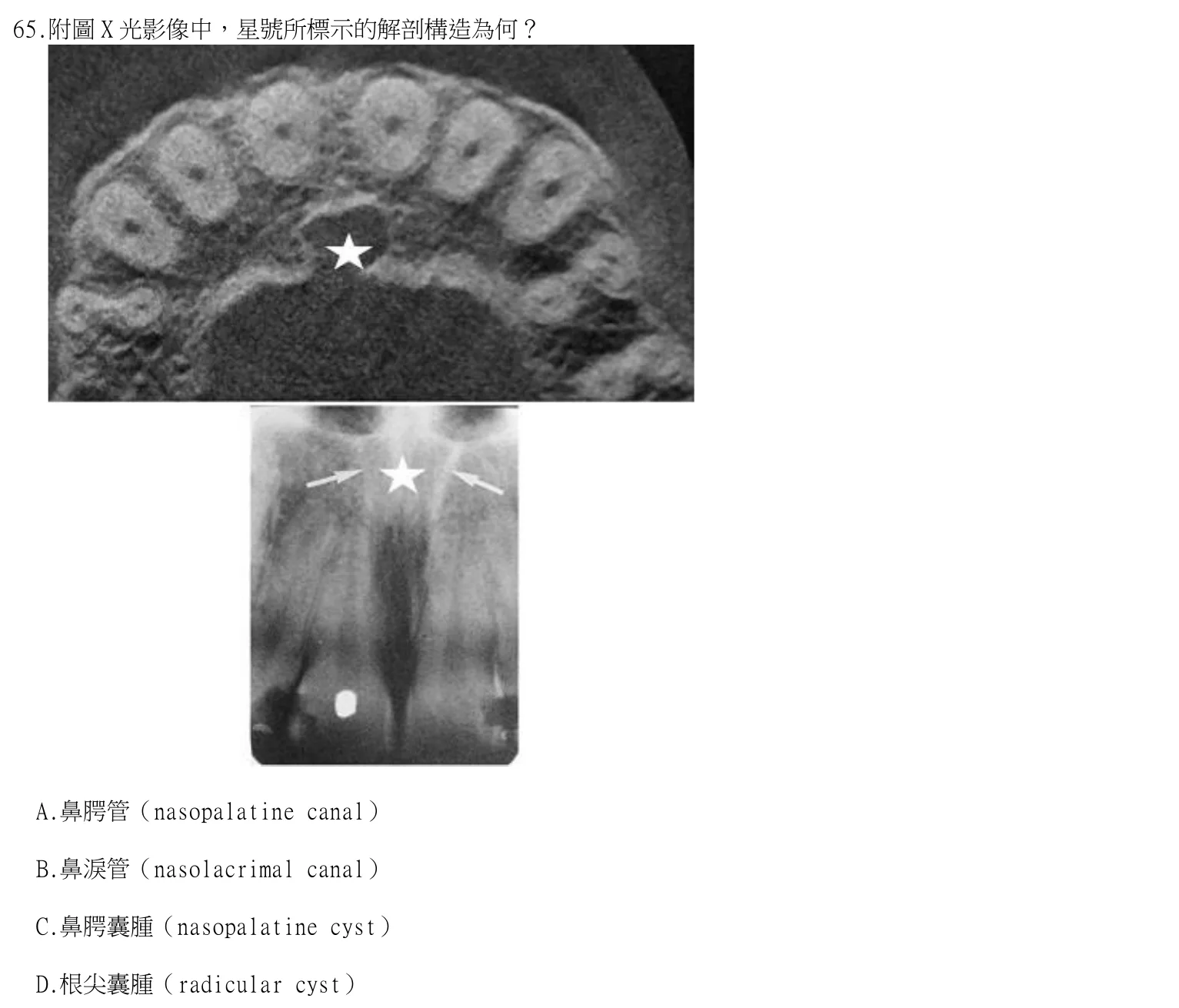 114 年第二次 牙醫學（四） 第 65 題附圖