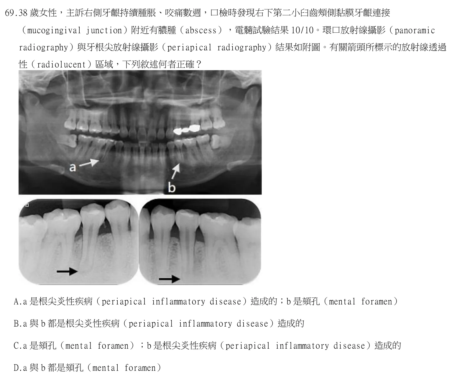 114 年第二次 牙醫學（四） 第 69 題附圖