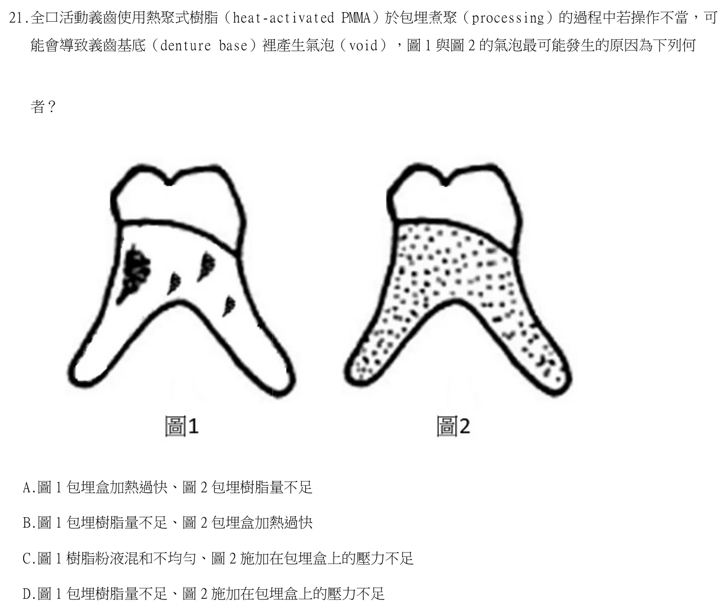 114 年第二次 牙醫學(五) 第 21 題附圖