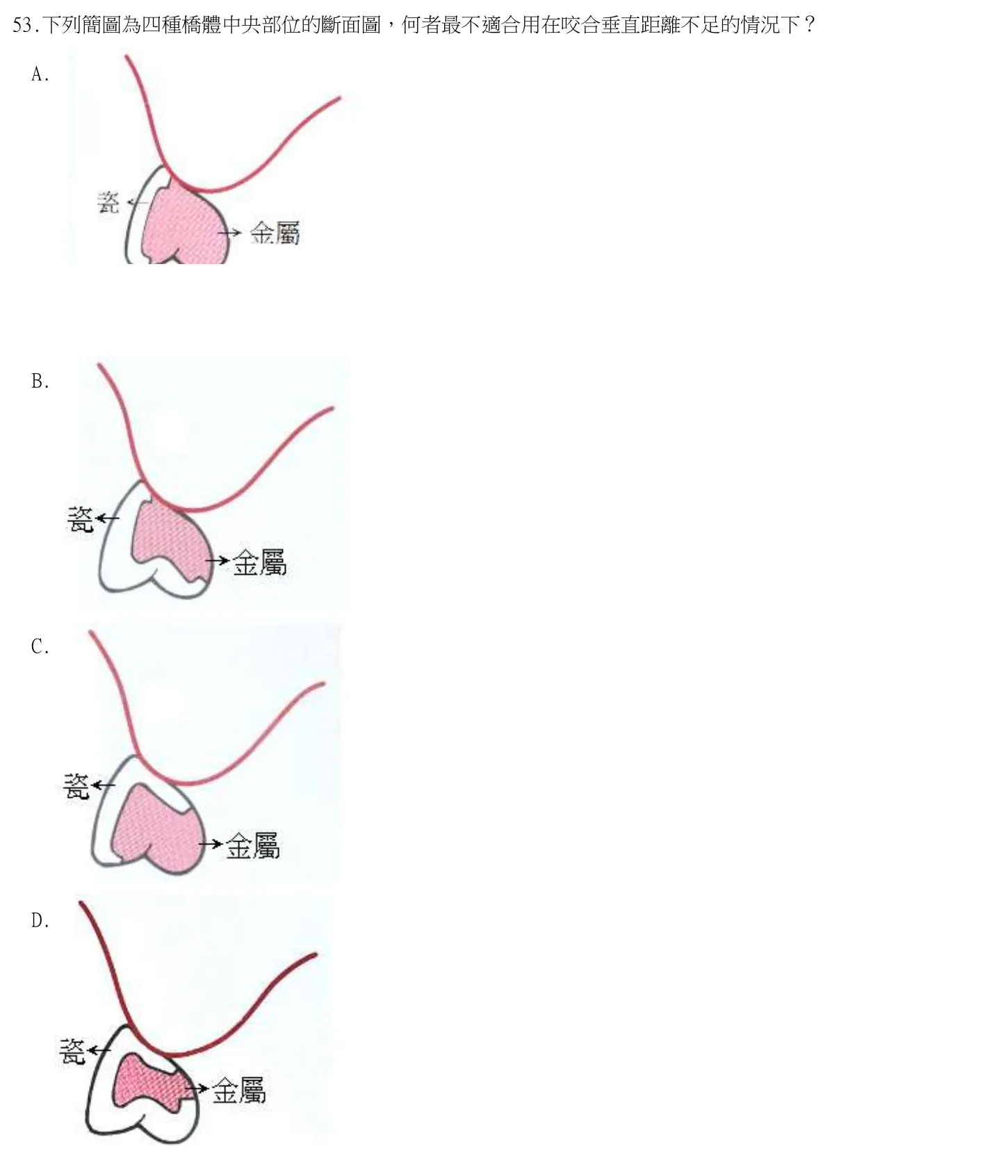 114 年第二次 牙醫學(五) 第 53 題附圖