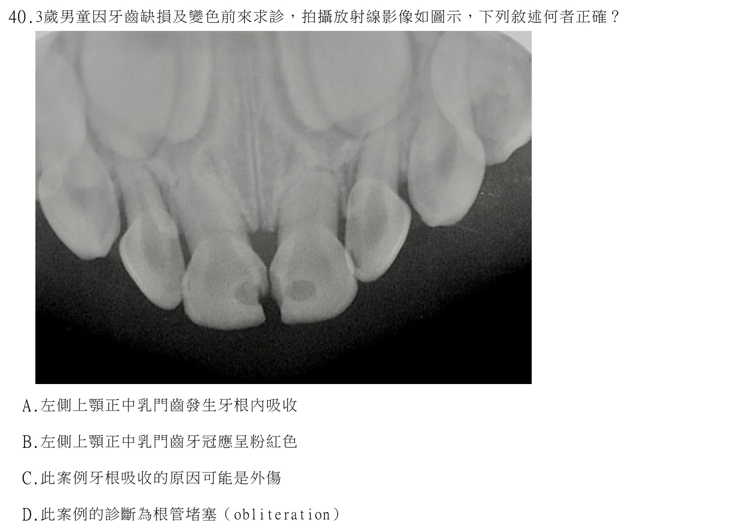 114 年第二次 牙醫學(六) 第 40 題附圖