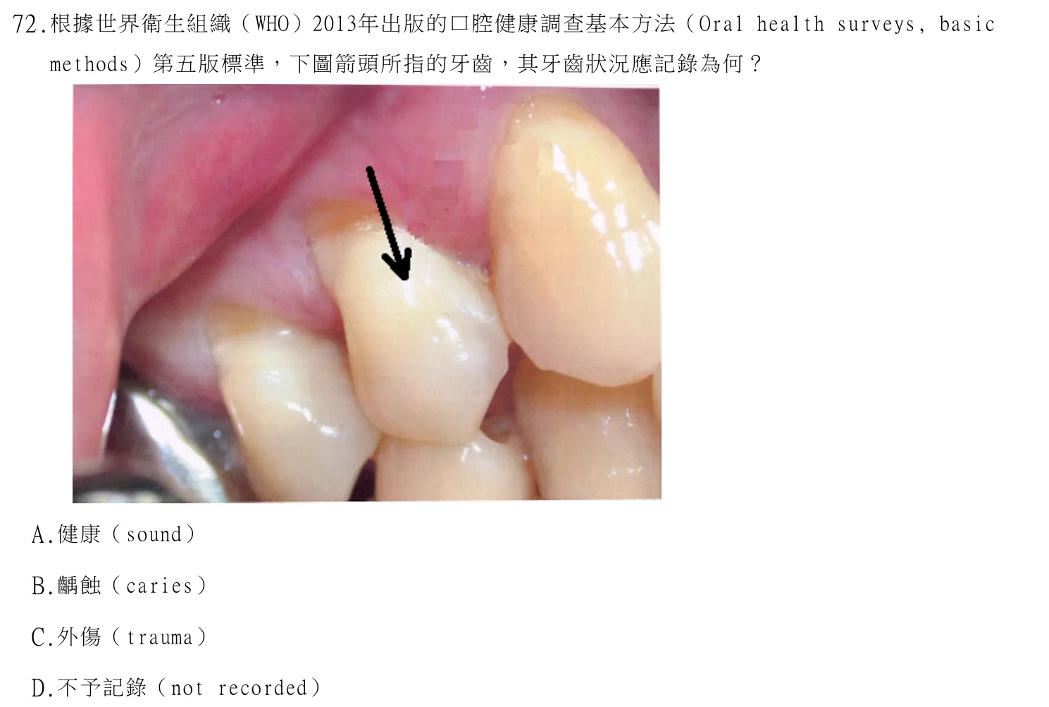 114 年第二次 牙醫學(六) 第 72 題附圖