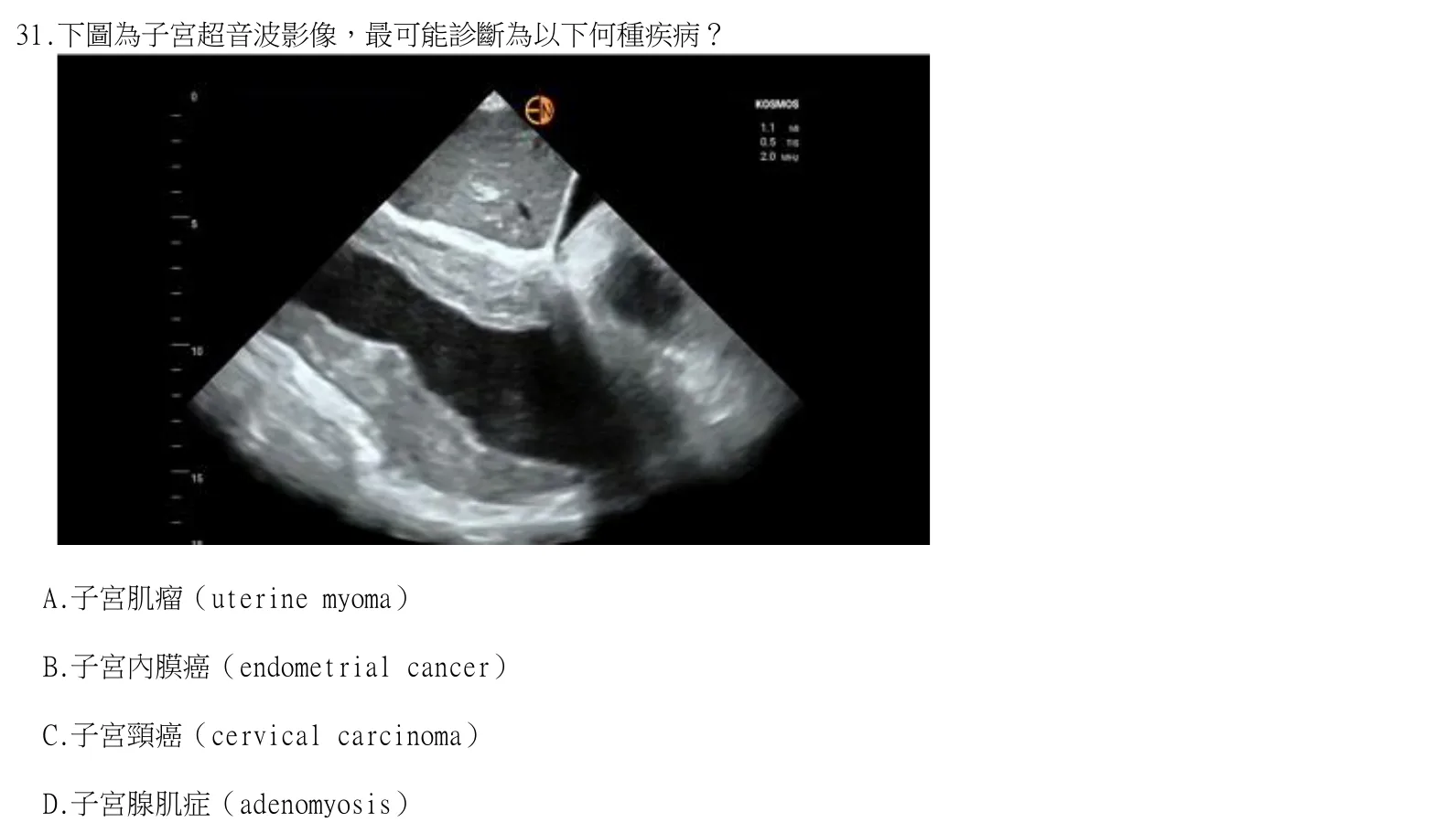 114 年第二次 臨床生理學與病理學 第 31 題附圖