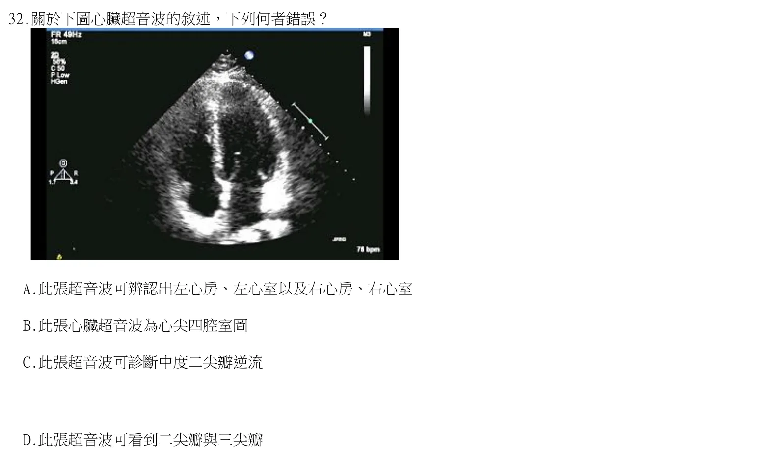 114 年第二次 臨床生理學與病理學 第 32 題附圖