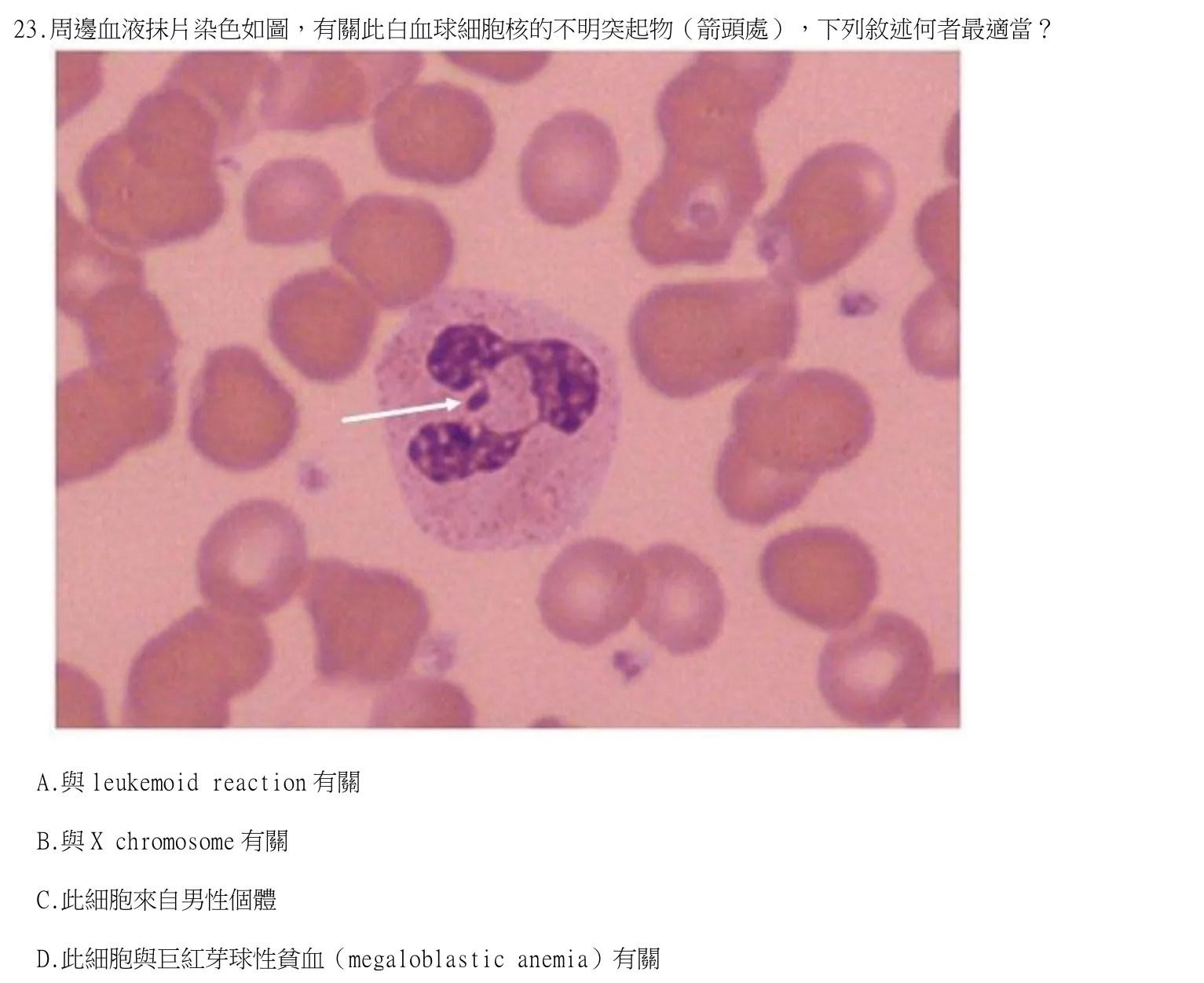 114 年第二次 臨床血液學與血庫學 第 23 題附圖
