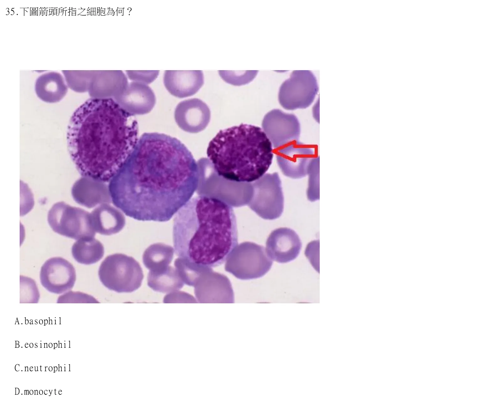 114 年第二次 臨床血液學與血庫學 第 35 題附圖