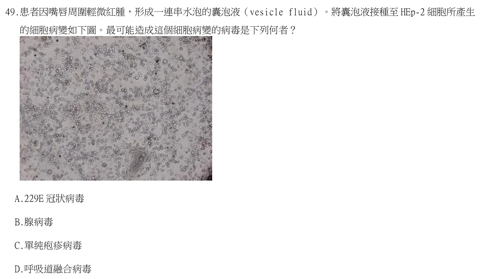 114 年第二次 臨床血清免疫學與臨床病毒學 第 49 題附圖