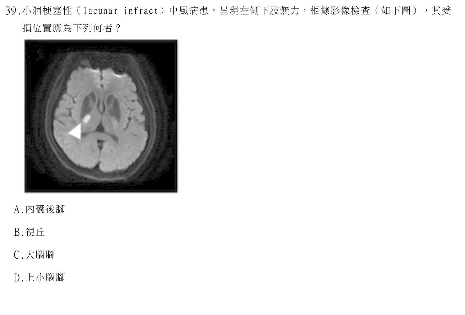 114 年第二次 神經疾病物理治療學 第 39 題附圖