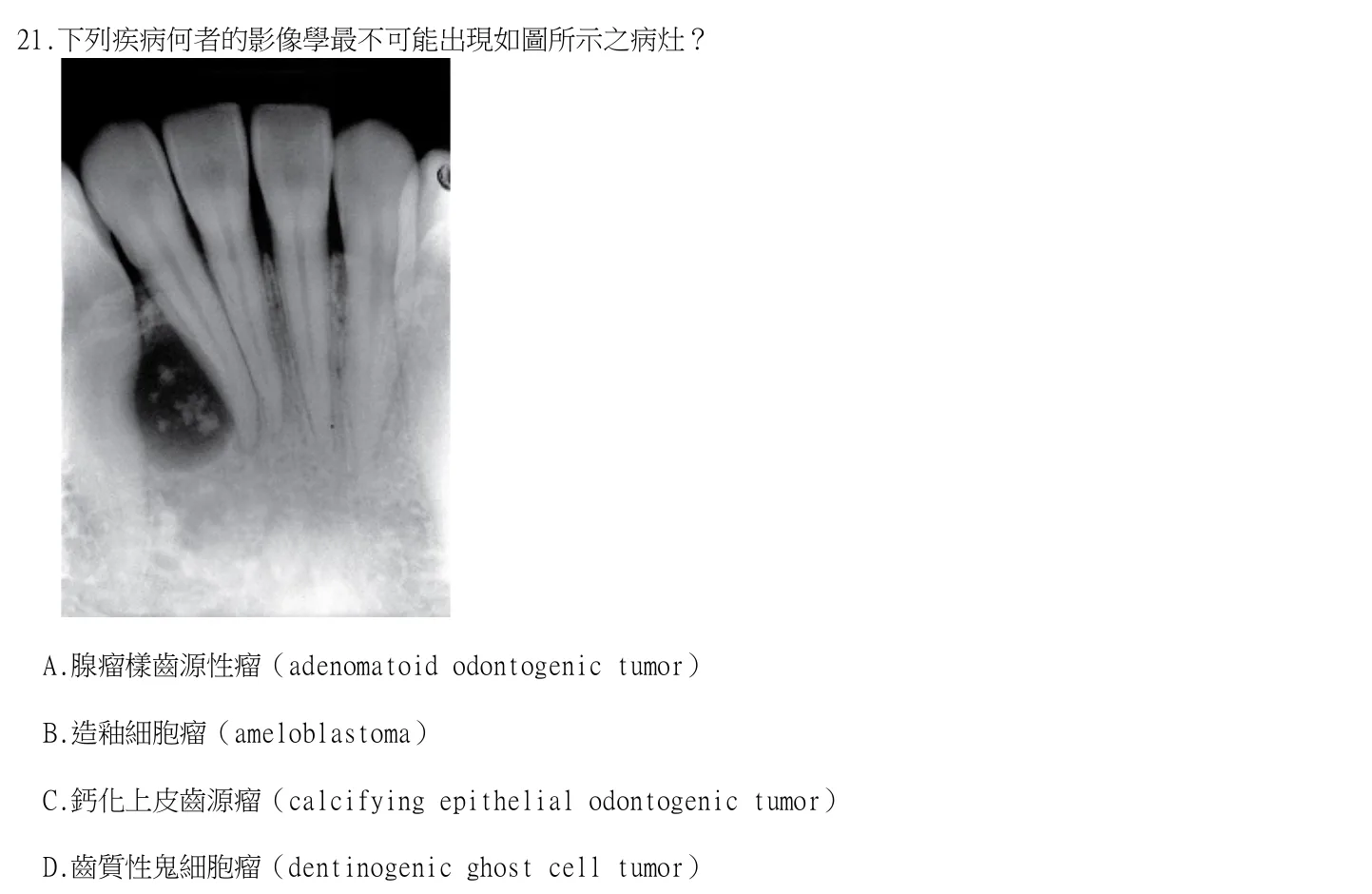 115 年第一次 牙醫學（二） 第 21 題附圖