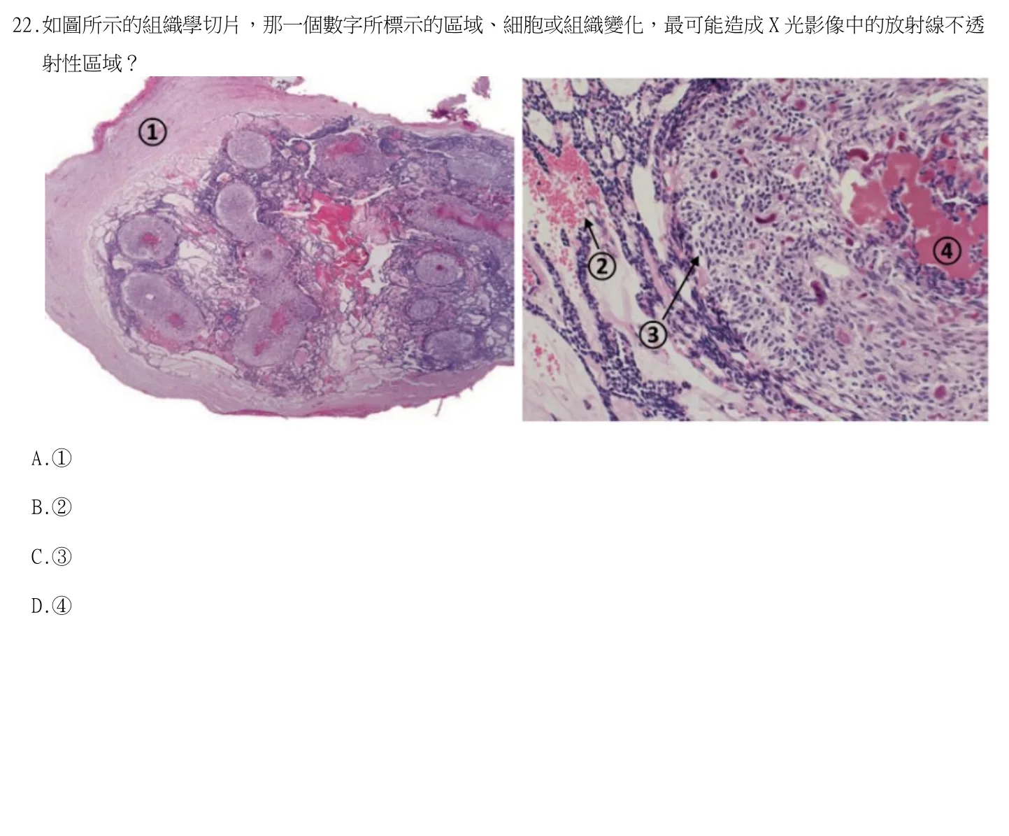 115 年第一次 牙醫學（二） 第 22 題附圖