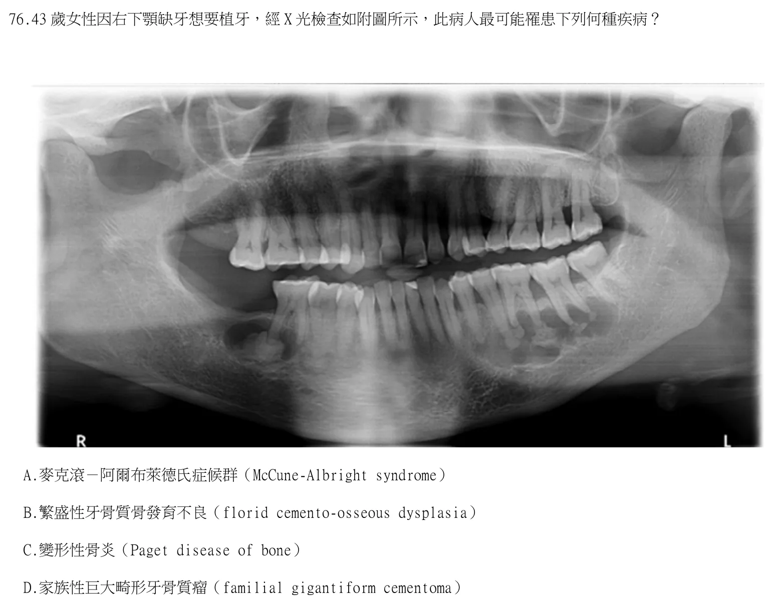 115 年第一次 牙醫學(四) 第 76 題附圖