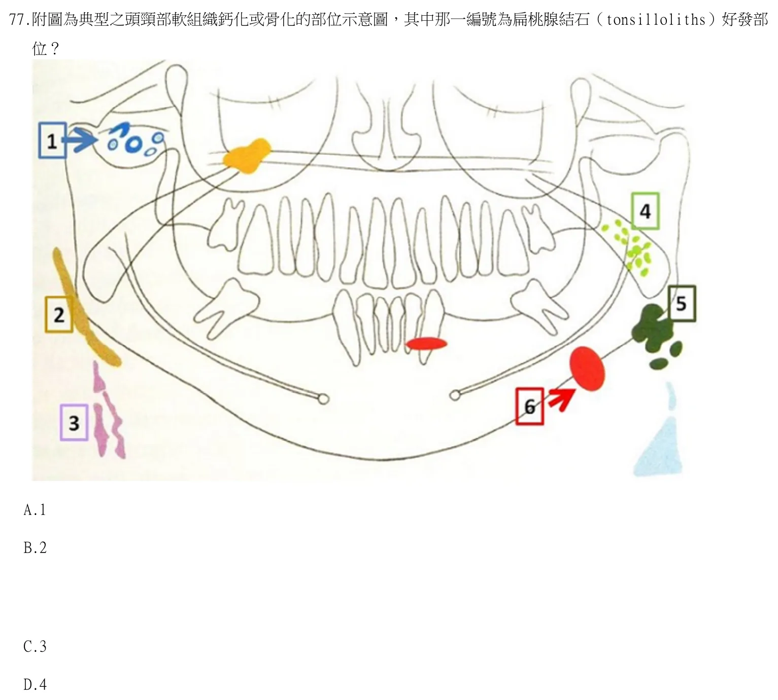 115 年第一次 牙醫學(四) 第 77 題附圖