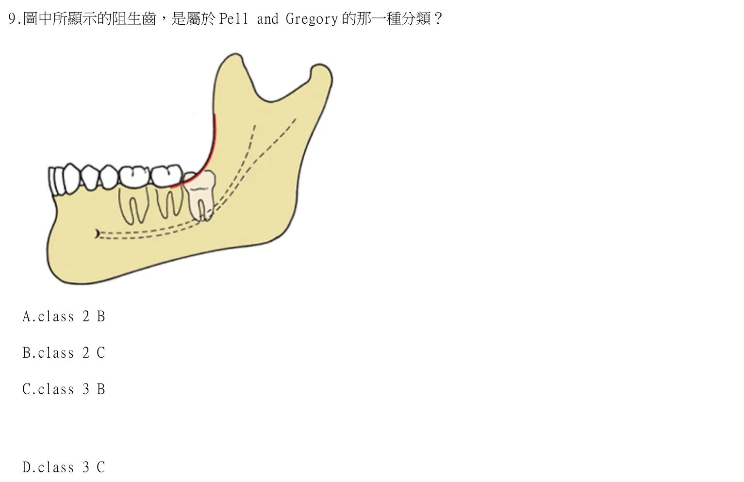 115 年第一次 牙醫學(四) 第 9 題附圖