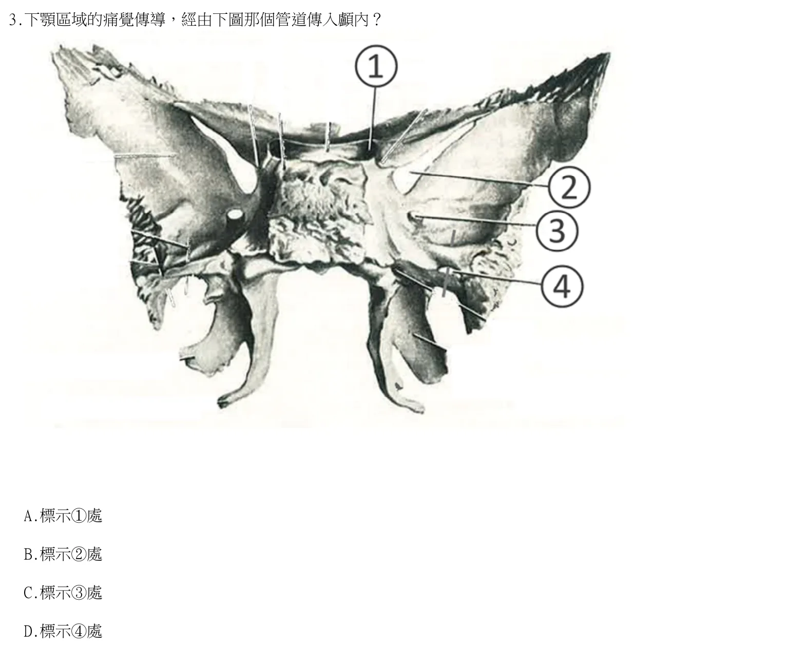 115 年第二次 牙醫學(一) 第 3 題附圖