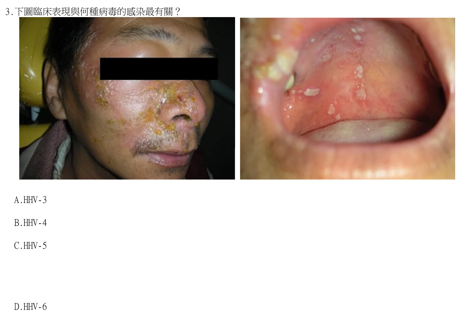 115 年第二次 牙醫學（二） 第 3 題附圖