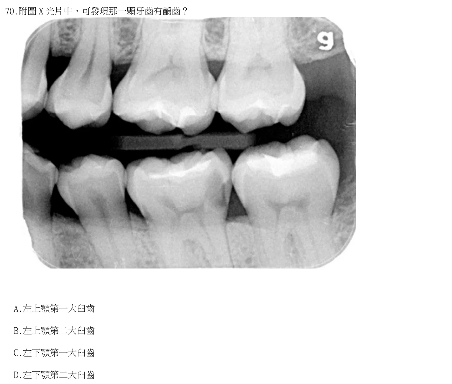 115 年第二次 牙醫學(四) 第 70 題附圖