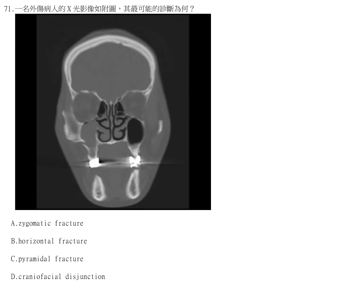 115 年第二次 牙醫學(四) 第 71 題附圖