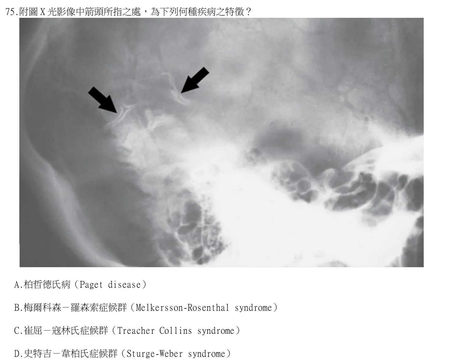 115 年第二次 牙醫學(四) 第 75 題附圖