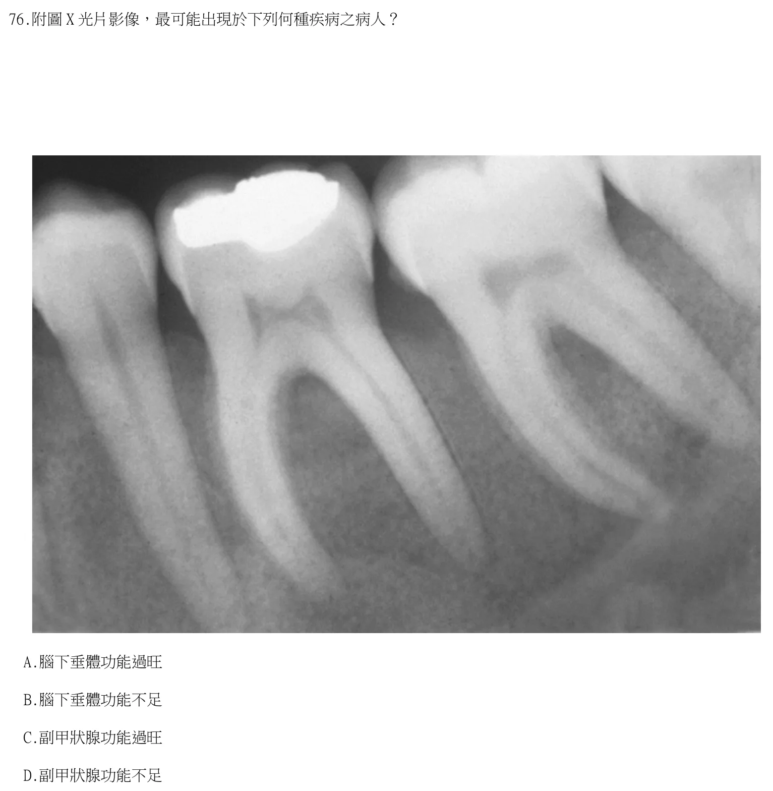 115 年第二次 牙醫學(四) 第 76 題附圖