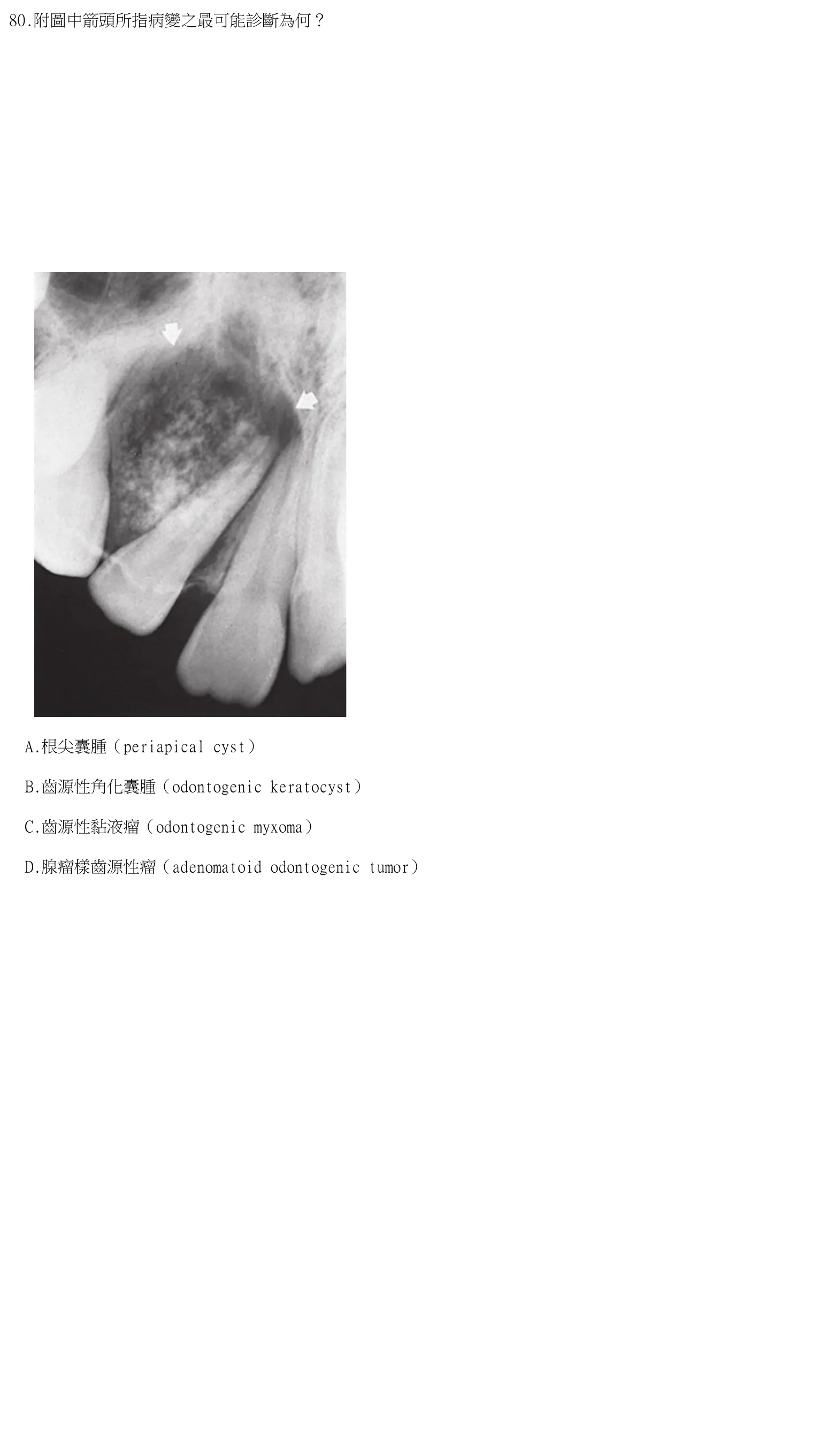 115 年第二次 牙醫學(四) 第 80 題附圖
