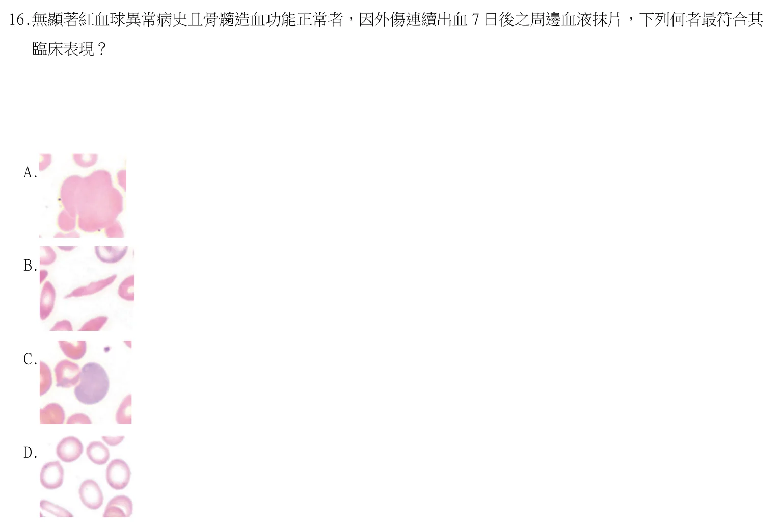 115 年第二次 臨床血液學與血庫學 第 16 題附圖