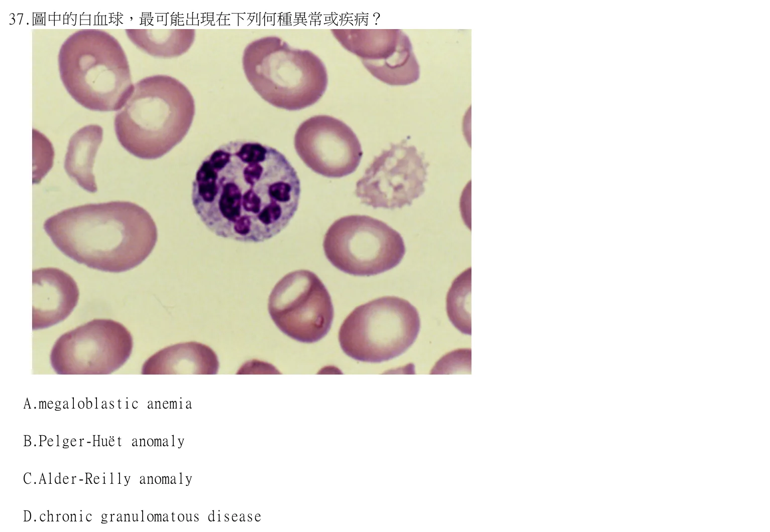 115 年第二次 臨床血液學與血庫學 第 37 題附圖